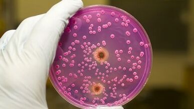 Inspire male pathology discharge